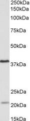 Kelch Domain Containing 8B antibody, PA5-37992, Invitrogen Antibodies, Western Blot image 