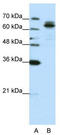 Fragile X mental retardation syndrome-related protein 1 antibody, TA345734, Origene, Western Blot image 