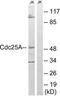 Cell Division Cycle 25A antibody, TA313586, Origene, Western Blot image 