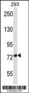 ADAM Metallopeptidase Domain 32 antibody, 57-781, ProSci, Western Blot image 