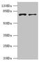 GLGB antibody, LS-C675796, Lifespan Biosciences, Western Blot image 