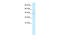 E3 ubiquitin-protein ligase TRIM13 antibody, 28-015, ProSci, Enzyme Linked Immunosorbent Assay image 