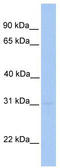 Monocyte to macrophage differentiation factor 2 antibody, TA334997, Origene, Western Blot image 