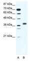 Basic Helix-Loop-Helix Family Member E22 antibody, GTX44609, GeneTex, Western Blot image 