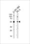 Protein DEK antibody, 63-827, ProSci, Western Blot image 