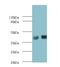 Sex Hormone Binding Globulin antibody, LS-C318459, Lifespan Biosciences, Western Blot image 