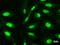 Chromodomain-helicase-DNA-binding protein 6 antibody, LS-C342418, Lifespan Biosciences, Immunofluorescence image 