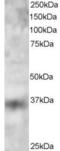 Krueppel-like factor 16 antibody, LS-B10273, Lifespan Biosciences, Western Blot image 