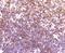 Lymphocyte-specific protein 1 antibody, A02992-1, Boster Biological Technology, Immunohistochemistry paraffin image 