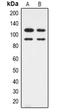 Cyclin-dependent kinase 11B antibody, LS-C368648, Lifespan Biosciences, Western Blot image 