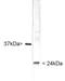 Ubiquitin C-Terminal Hydrolase L1 antibody, TA336532, Origene, Western Blot image 