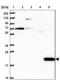 Cancer/Testis Antigen Family 45 Member A1 antibody, NBP2-46704, Novus Biologicals, Western Blot image 