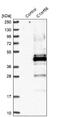 Chromosome 1 Open Reading Frame 56 antibody, NBP2-32683, Novus Biologicals, Western Blot image 