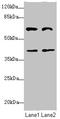 Decapping MRNA 1A antibody, LS-C675620, Lifespan Biosciences, Western Blot image 