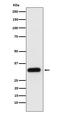 Apolipoprotein F antibody, M07726, Boster Biological Technology, Western Blot image 