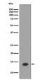 Histone Cluster 1 H2A Family Member E antibody, M16777-2, Boster Biological Technology, Western Blot image 