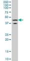 LIM Homeobox 5 antibody, H00064211-M05, Novus Biologicals, Western Blot image 