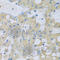 NADH:Ubiquinone Oxidoreductase Subunit A7 antibody, A8441, ABclonal Technology, Immunohistochemistry paraffin image 