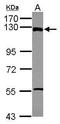 Zinc Finger And BTB Domain Containing 21 antibody, GTX116110, GeneTex, Western Blot image 