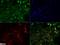 NUT Midline Carcinoma Family Member 1 antibody, NBP2-31147, Novus Biologicals, Immunofluorescence image 