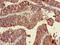 Tripartite Motif Containing 54 antibody, CSB-PA861180LA01HU, Cusabio, Immunohistochemistry paraffin image 