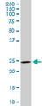DCN1-like protein 1 antibody, LS-C139521, Lifespan Biosciences, Western Blot image 