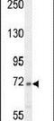 Complement C2 antibody, PA5-24158, Invitrogen Antibodies, Western Blot image 