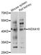 Homeobox protein Hox-A10 antibody, A8550, ABclonal Technology, Western Blot image 