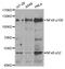 Nuclear factor NF-kappa-B p100 subunit antibody, TA332771, Origene, Western Blot image 