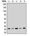 Succinate Dehydrogenase Complex Iron Sulfur Subunit B antibody, orb411826, Biorbyt, Western Blot image 