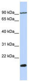 Transmembrane 4 L Six Family Member 4 antibody, TA339426, Origene, Western Blot image 