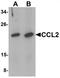 C-C Motif Chemokine Ligand 2 antibody, TA319701, Origene, Western Blot image 