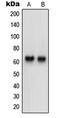 hNT antibody, GTX55202, GeneTex, Western Blot image 