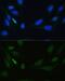 DNA Ligase 4 antibody, GTX55592, GeneTex, Immunofluorescence image 