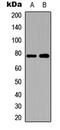 SKI Like Proto-Oncogene antibody, LS-C368515, Lifespan Biosciences, Western Blot image 