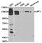 UPF1 RNA Helicase And ATPase antibody, TA327064, Origene, Western Blot image 