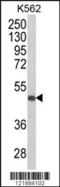 Killer Cell Immunoglobulin Like Receptor, Three Ig Domains And Short Cytoplasmic Tail 1 antibody, 63-582, ProSci, Western Blot image 