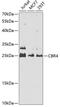 Carbonyl Reductase 4 antibody, GTX33068, GeneTex, Western Blot image 