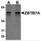Zinc Finger And BTB Domain Containing 7A antibody, MBS150670, MyBioSource, Western Blot image 