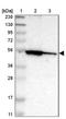 Fatty Acyl-CoA Reductase 1 antibody, NBP1-89847, Novus Biologicals, Western Blot image 