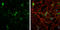 5-Hydroxytryptamine Receptor 1A antibody, GTX104703, GeneTex, Immunocytochemistry image 