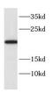 Cytochrome B5 Type B antibody, FNab02114, FineTest, Western Blot image 