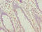 Hyaluronan-binding protein 2 antibody, LS-C370743, Lifespan Biosciences, Immunohistochemistry paraffin image 