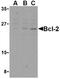 BCL2 antibody, TA306172, Origene, Western Blot image 