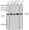 DNA Polymerase Epsilon 4, Accessory Subunit antibody, GTX64960, GeneTex, Western Blot image 