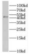 Protein C inhibitor antibody, FNab06806, FineTest, Western Blot image 