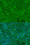 Dicer 1, Ribonuclease III antibody, 16-238, ProSci, Immunofluorescence image 