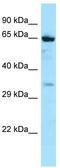 NADPH oxidase 5 antibody, TA338656, Origene, Western Blot image 