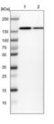 Small Integral Membrane Protein 20 antibody, NBP1-90943, Novus Biologicals, Western Blot image 