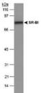 Scavenger Receptor Class B Member 1 antibody, PA3-16786, Invitrogen Antibodies, Western Blot image 